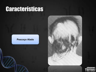 Características
Pescoço Alado
 