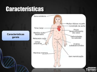 Características
Características
gerais
 