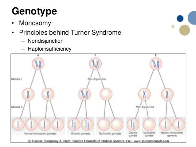 Turner syndrome presentation last