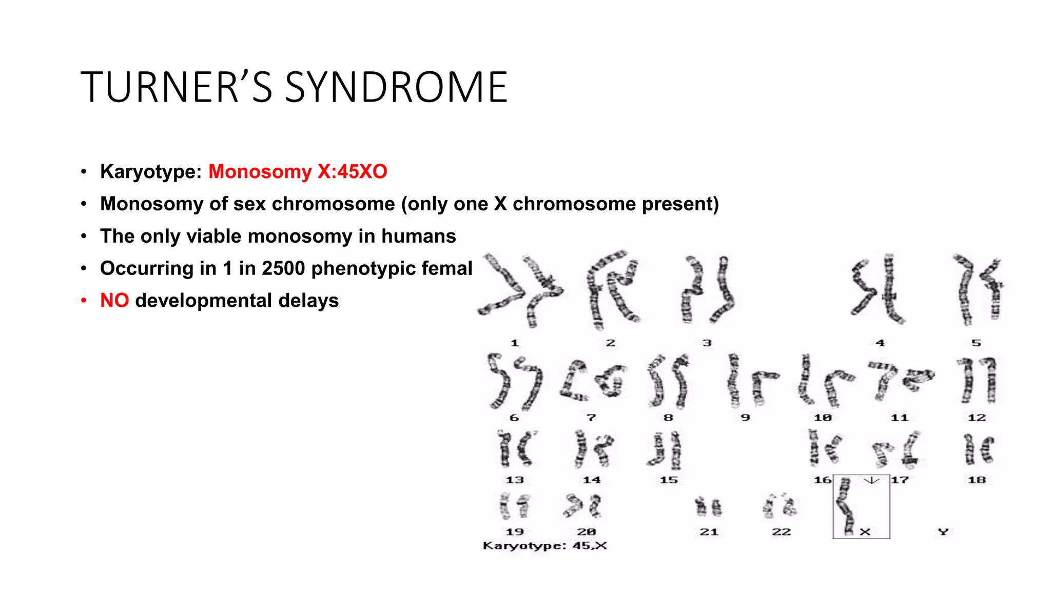 TURNERS & KLIENFELTERS SYNDROME.pptx