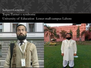 Subject:Genetics
Topic:Turner s syndrome
University of Education Lower mall campus Lahore
 