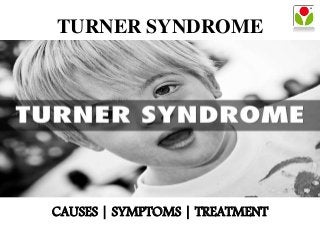 TURNER SYNDROME
CAUSES | SYMPTOMS | TREATMENT
 