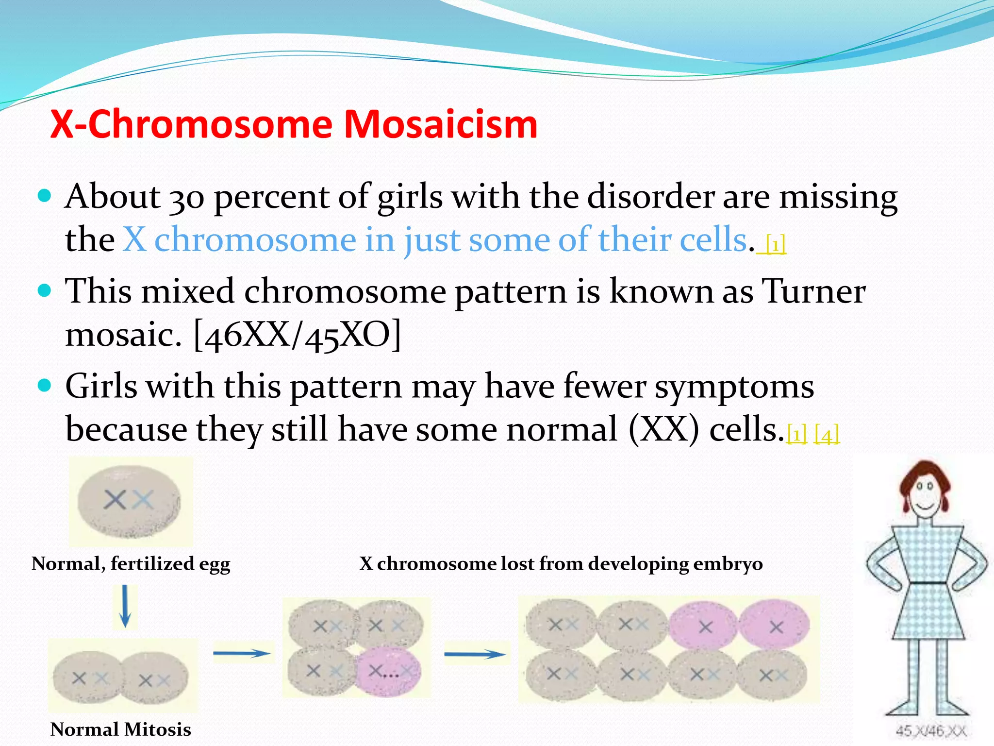 Turner syndrome | PPTX