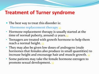 turner syndrome facts