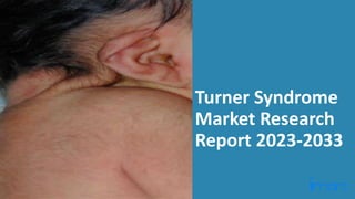 Turner Syndrome
Market Research
Report 2023-2033
 