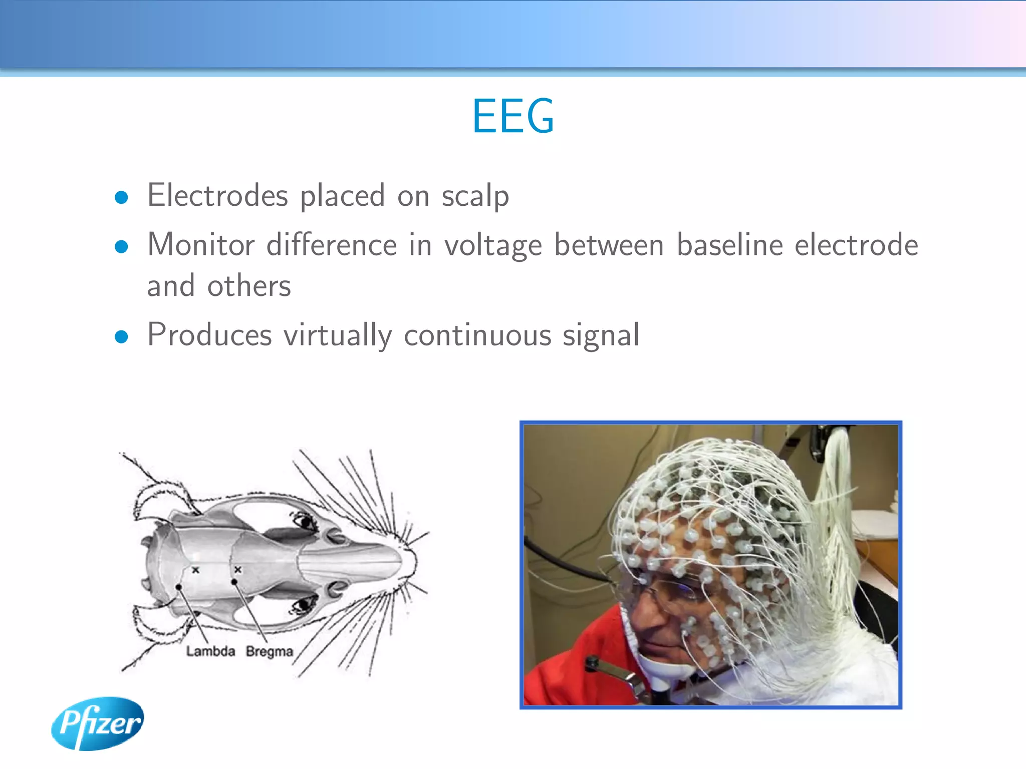 EEG
• Electrodes placed on scalp
• Monitor diﬀerence in voltage between baseline electrode
  and others
• Produces virtually continuous signal
 
