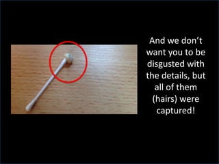 And we don’t
want you to be
disgusted with
the details, but
all of them
(hairs) were
captured!
 