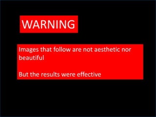 So
WARNING
Images that follow are not aesthetic nor
beautiful
But the results were effective
 
