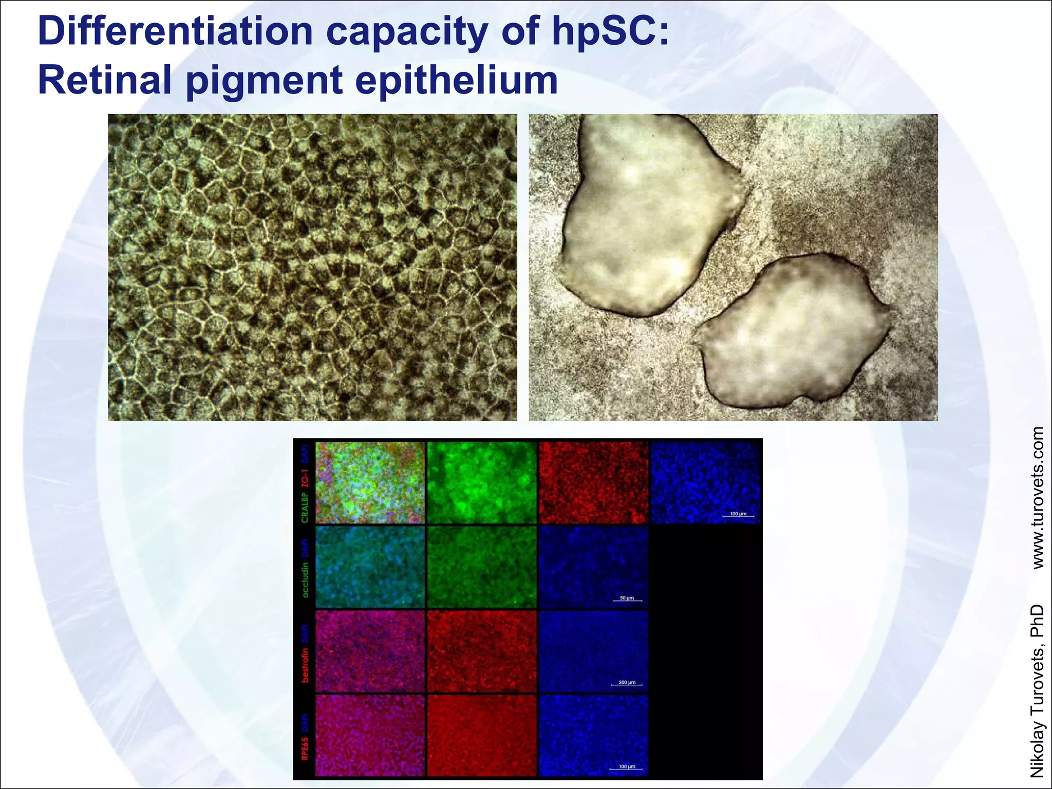 Differentiation capacity of hpSC:  Retinal pigment epithelium Nikolay Turovets, PhD  www.turovets.com 