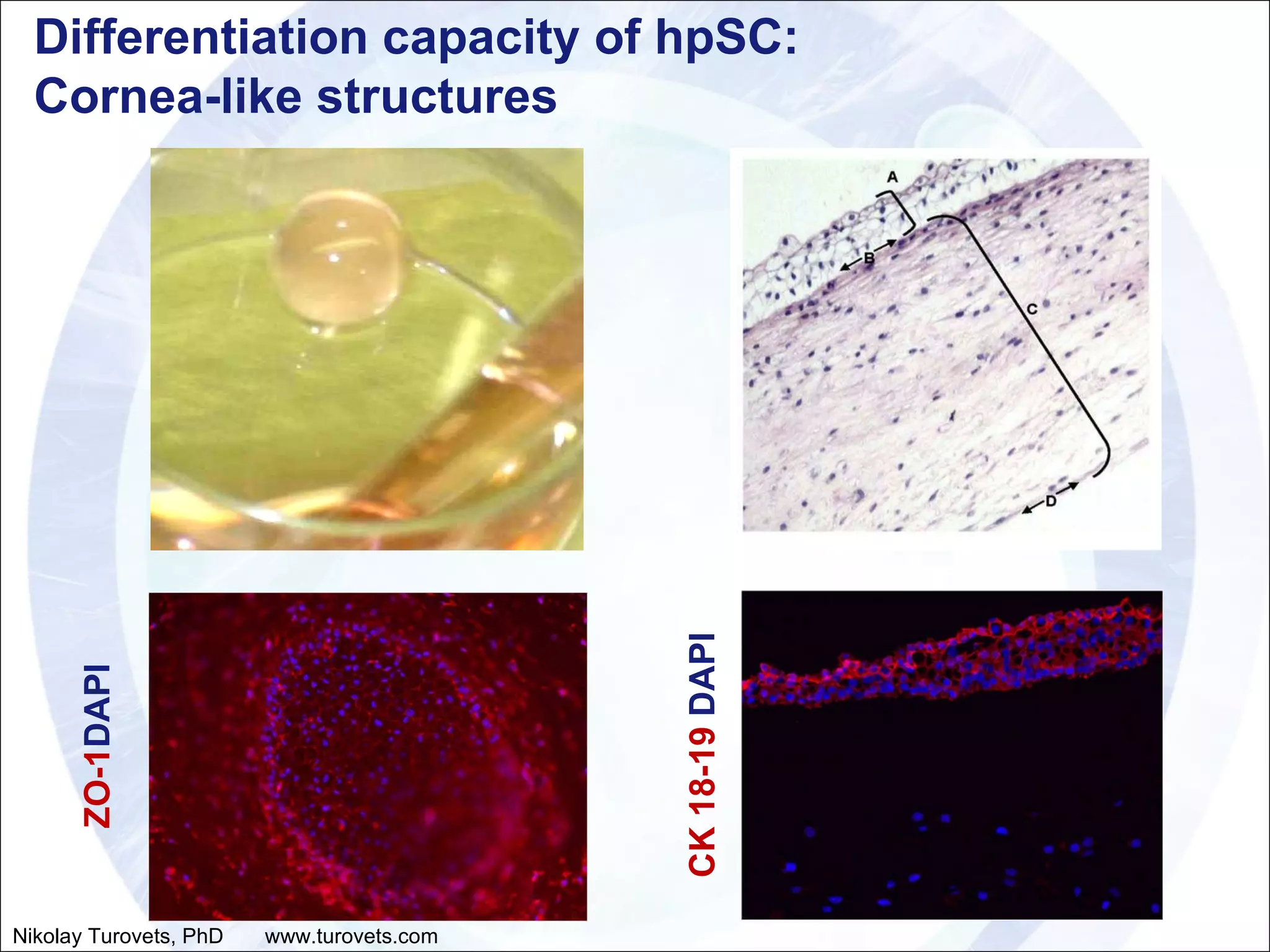 Differentiation capacity of hpSC:  Cornea-like structures CK 18-19  DAPI ZO-1 DAPI Nikolay Turovets, PhD  www.turovets.com 