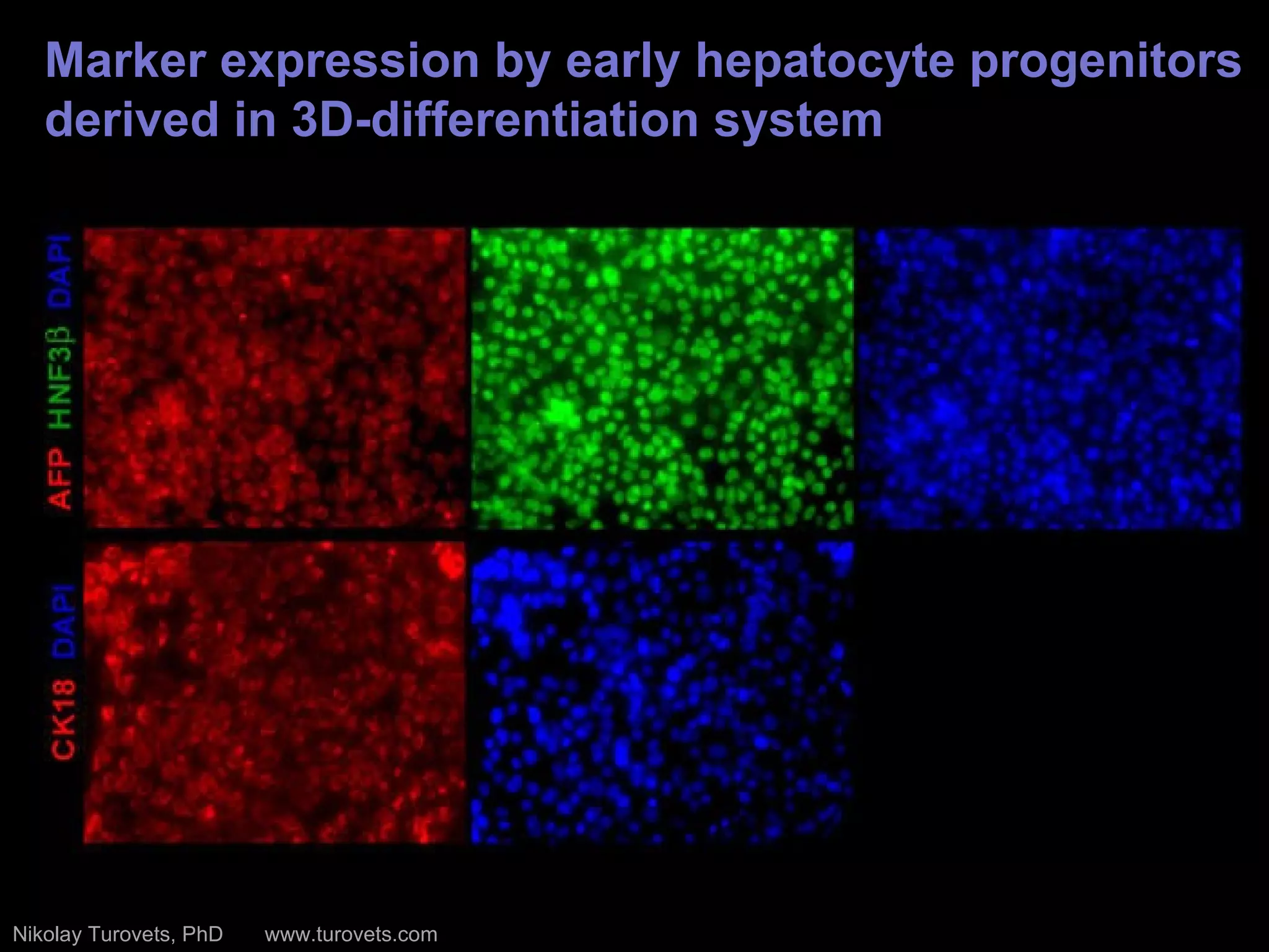 Marker expression by  early hepatocyte progenitors derived  in 3D-differentiation system Nikolay Turovets, PhD  www.turovets.com 