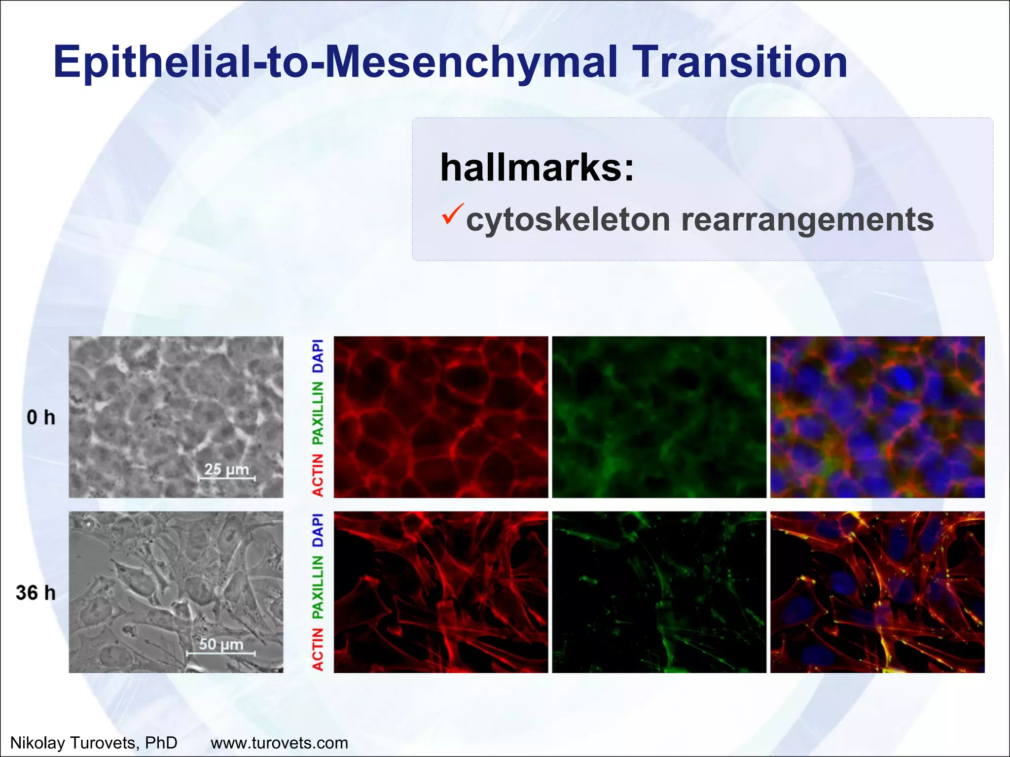Epithelial-to-Mesenchymal Transition hallmarks: cytoskeleton rearrangements Nikolay Turovets, PhD  www.turovets.com 