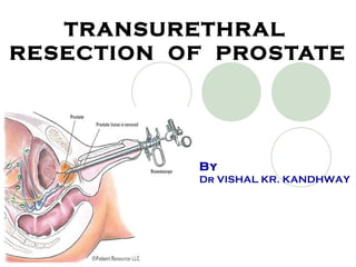 TRANSURETHRAL
RESECTION OF PROSTATE
By
Dr VISHAL KR. KANDHWAY
 