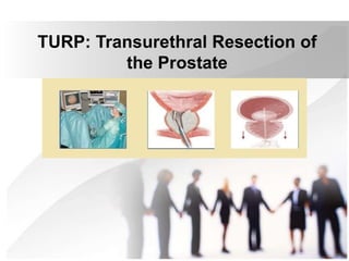 TURP: Transurethral Resection of
the Prostate
 
