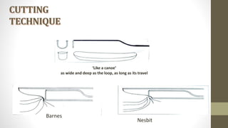 CUTTING
TECHNIQUE
Nesbit
Barnes
‘Like a canoe’
as wide and deep as the loop, as long as its travel
 