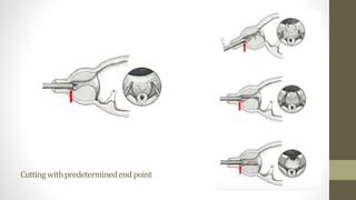 Cuttingwithpredeterminedendpoint
 