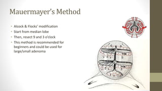 Mauermayer’s Method
• Alcock & Flocks’ modification
• Start from median lobe
• Then, resect 9 and 3 o’clock
• This method is recommended for
beginners and could be used for
large/small adenoma
 