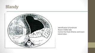Blandy
Identification of landmark
Resect middle lobe
Control the Flock Arteries and resect
lateral lobes
 
