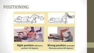 Positioning
POSITIONING
 