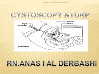 ANAS I AL DERBASHI .RN ,KHCC CYSTOSCOPY &TURP 1 RN.ANAS I AL DERBASHI  