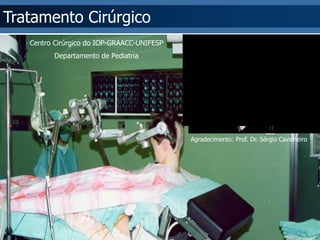 Tratamento Cirúrgico 
Centro Cirúrgico do IOP-GRAACC-UNIFESP 
Departamento de Pediatria 
Agradecimento: Prof. Dr. Sérgio Cavalheiro  