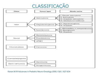 CLASSIFICAÇÃO 
Kieran,M.W Advances in Pediatric Neuro-Oncology-2000,13(6 ) :627-634 
 