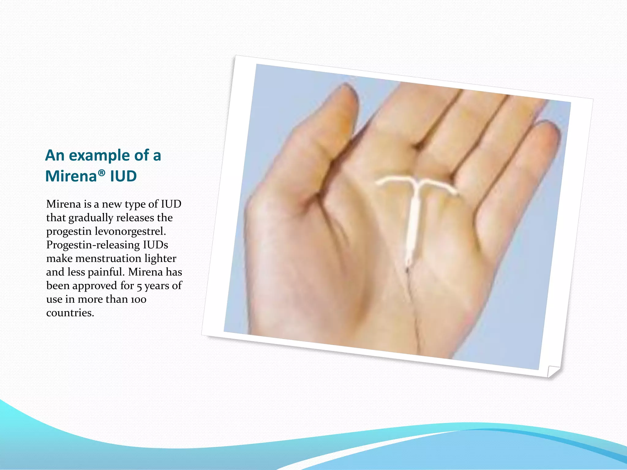 An example of a
Mirena® IUD
Mirena is a new type of IUD
that gradually releases the
progestin levonorgestrel.
Progestin-releasing IUDs
make menstruation lighter
and less painful. Mirena has
been approved for 5 years of
use in more than 100
countries.
 
