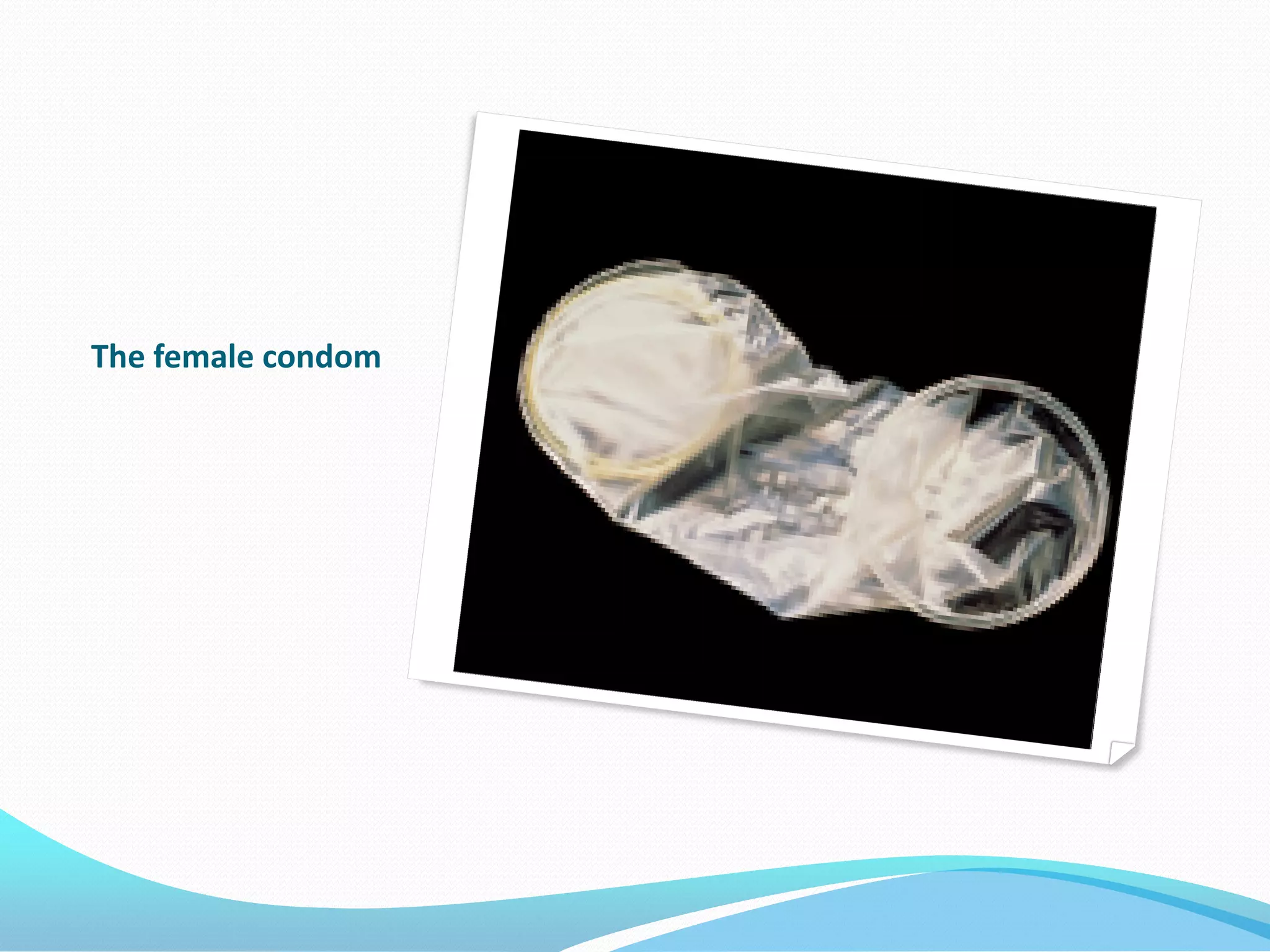 The female condom
 