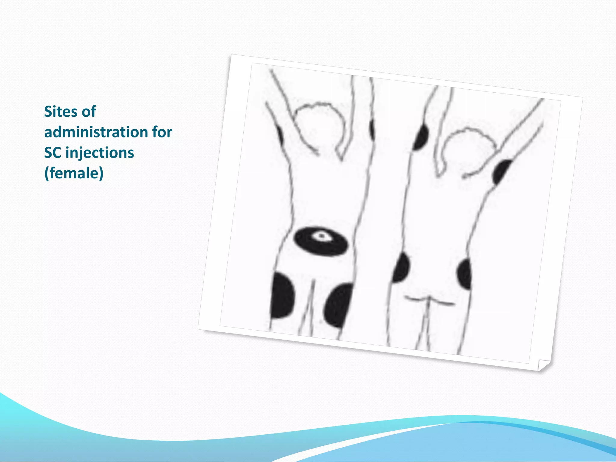 Sites of
administration for
SC injections
(female)
 