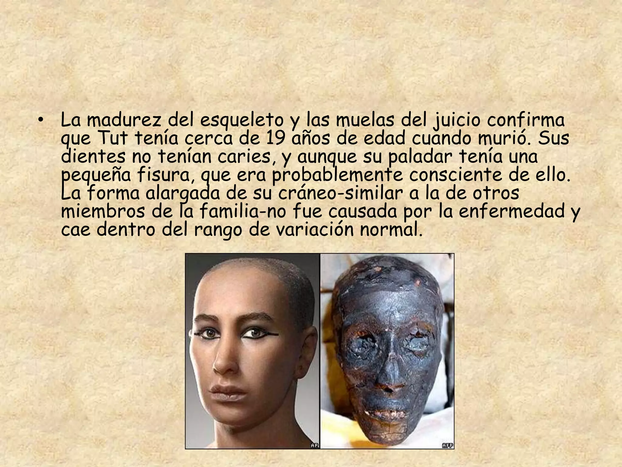 • La madurez del esqueleto y las muelas del juicio confirma 
que Tut tenía cerca de 19 años de edad cuando murió. Sus 
dientes no tenían caries, y aunque su paladar tenía una 
pequeña fisura, que era probablemente consciente de ello. 
La forma alargada de su cráneo-similar a la de otros 
miembros de la familia-no fue causada por la enfermedad y 
cae dentro del rango de variación normal. 
 