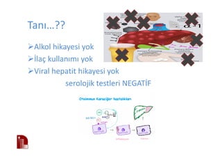Tanı…??
Alkol hikayesi yok
İlaç kullanımı yok
Viral hepatit hikayesi yok
serolojik testleri NEGATİF
 