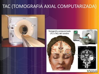 TAC (TOMOGRAFIA AXIAL COMPUTARIZADA)

 