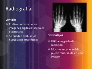 Radiografía
Ventajas
 El alto contraste de las
imágenes digitales facilita el
diagnóstico
 Se pueden evaluar los
huesos con esta técnica

Desventajas
 Utiliza un grado de
radiación
 Muchas veces el médico
puede tener duda en una
imagen

 