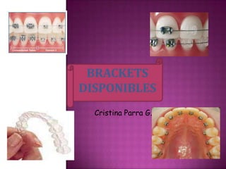 BRACKETS
DISPONIBLES
  Cristina Parra G.
 