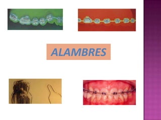 ALAMBRES
 