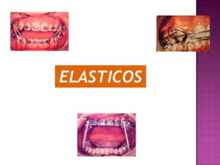 ELASTICOS
 