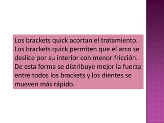 Los brackets quick acortan el tratamiento.
Los brackets quick permiten que el arco se
deslice por su interior con menor fricción.
De esta forma se distribuye mejor la fuerza
entre todos los brackets y los dientes se
mueven más rápido.
 