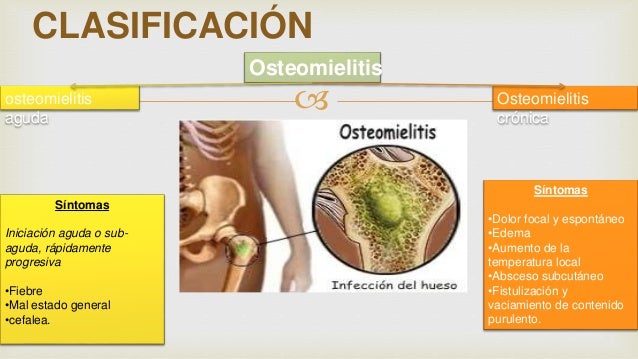 Resultado de imagen de osteomielitis sintomas