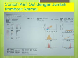 Contoh Print Out dengan Jumlah
Trombosit Normal

 