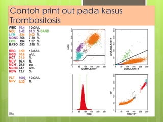 Contoh print out pada kasus
Trombositosis

 