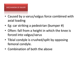 MECHANISM OF INJURY



• Caused by a varus/valgus force combined with
  axial loading
• Eg: car striking a pedestrian (bumper #)
• Often: fall from a height in which the knee is
  forced into valgus/varus
• Tibial condyle is crushed/split by opposing
  femoral condyle.
• Combination of both the above
 