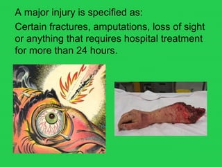 A major injury is specified as:
Certain fractures, amputations, loss of sight
or anything that requires hospital treatment
for more than 24 hours.
 