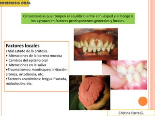 Cristina Parra G.
Factores locales
•Mal estado de la prótesis.
• Alteraciones de la barrera mucosa
• Cambios del epitelio oral
• Alteraciones en la saliva
•Traumatismos: mordisqueo, irritación
crónica, ortodoncia, etc.
•Factores anatómicos: lengua fisurada,
maloclusión, etc.
Circunstancias que rompen el equilibrio entre el huésped y el hongo y
los agrupan en factores predisponentes generales y locales.
 