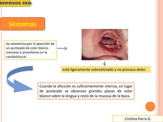 Cristina Parra G.
Se caracteriza por la aparición de
un punteado de color blanco
cremoso o amarillento en la
cavidad bucal.
está ligeramente sobreelevado y no provoca dolor.
Síntomas
Cuando la afección es suficientemente intensa, en lugar
de punteado se observan grandes placas de color
blanco sobre la lengua y resto de la mucosa de la boca.
 