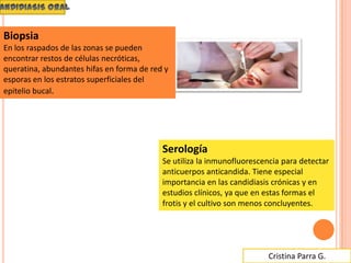 Cristina Parra G.
Biopsia
En los raspados de las zonas se pueden
encontrar restos de células necróticas,
queratina, abundantes hifas en forma de red y
esporas en los estratos superficiales del
epitelio bucal.
Serología
Se utiliza la inmunofluorescencia para detectar
anticuerpos anticandida. Tiene especial
importancia en las candidiasis crónicas y en
estudios clínicos, ya que en estas formas el
frotis y el cultivo son menos concluyentes.
 