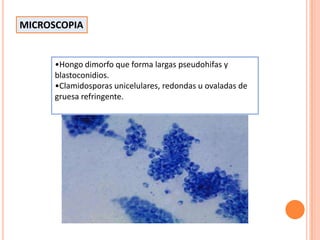 •Hongo dimorfo que forma largas pseudohifas y
blastoconidios.
•Clamidosporas unicelulares, redondas u ovaladas de
gruesa refringente.
MICROSCOPIA
 