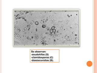 Se observan:
-seudohifas (S)
-clamidosporas (C)
-blastoconidias (B).
 