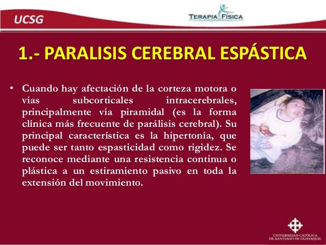PARALISIS CEREBRAL INFANTIL - PCI PARALISIS CEREBRAL INFANTIL - PCI