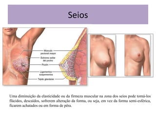 Seios

Uma diminuição da elasticidade ou da firmeza muscular na zona dos seios pode torná-los
flácidos, descaídos, sofrerem alteração da forma, ou seja, em vez da forma semi-esférica,
ficarem achatados ou em forma de pêra.

 