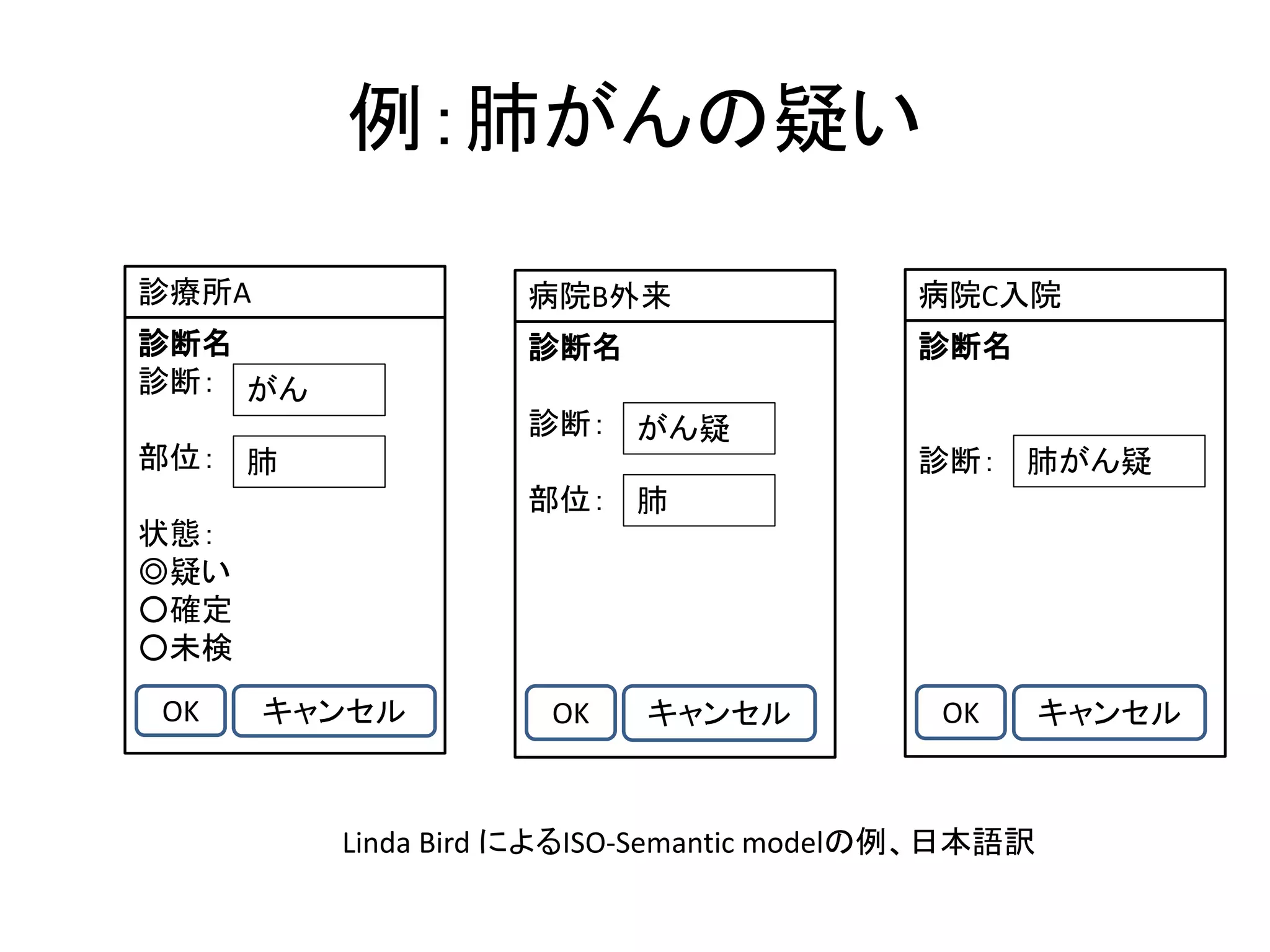 例：肺がんの疑い
診療所A
診断名
診断：
部位：
状態：
◎疑い
○確定
○未検
がん
肺
OK キャンセル
病院B外来
診断名
診断：
部位：
がん疑
肺
OK キャンセル
病院C入院
診断名
診断： 肺がん疑
OK キャンセル
Linda Bird によるISO-Semantic modelの例、日本語訳
 